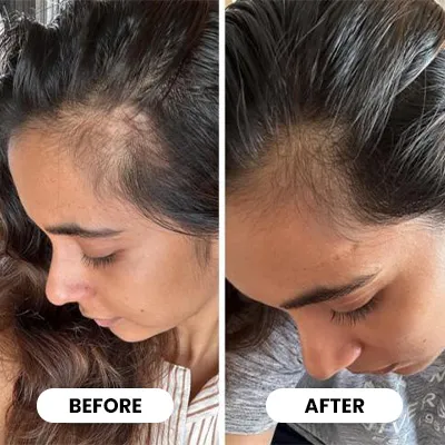 Glokore Scalp Massager